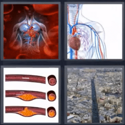 Soluciones-4-Fotos-1-palabra-arteria