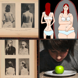 1-Palabra-4-Fotos-nivel-15.44-Anorexia